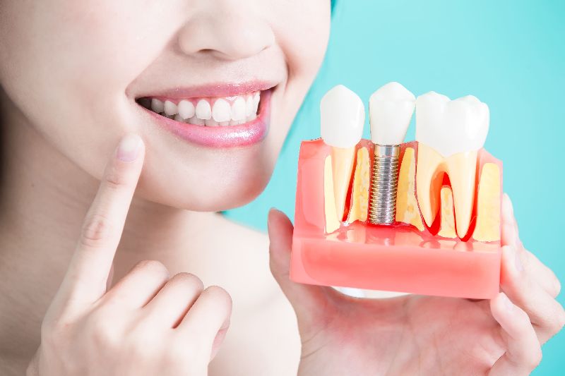 Dental Implant Fixing Services