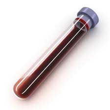 Plastic blood test tube, Feature : Cold Resistance, Crack Proof, Disposable, Eco Friendly, Heat Resistance