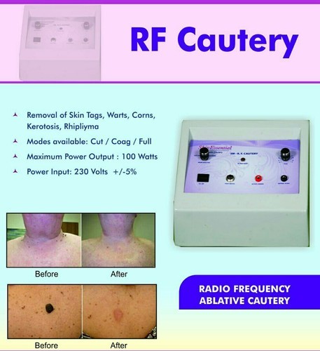 Rf Cautery, for Clinical Purpose