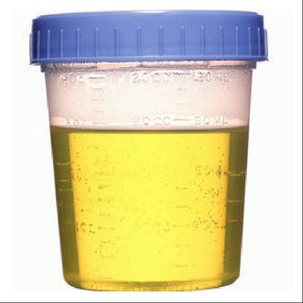 Fresh Cow Urine, for Agriculture Use, Grade : Medicine Grade