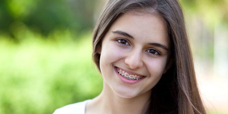 Orthodontic Treatment Services