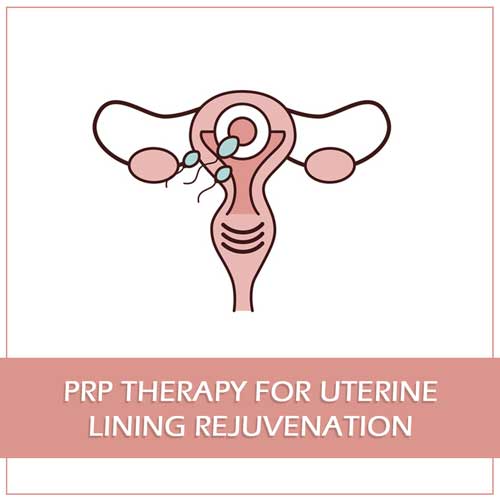 Uterine Rejuvenation Therapy