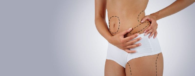 Best Liposuction Treatment In Ahmedabad Gujarat