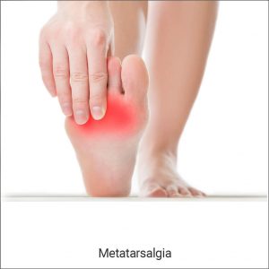 Metatarsalgia or Ball of Foot Pain Treatment in Kolkata
