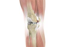 Ligament Injury Treatment Services