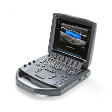 Electric Sonosite Ultrasound Machine, for Clinical Use, Hospital Use, Voltage : 220V, 380V