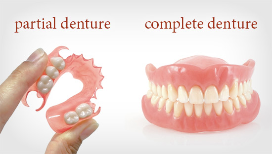 Partial and Complete Denture