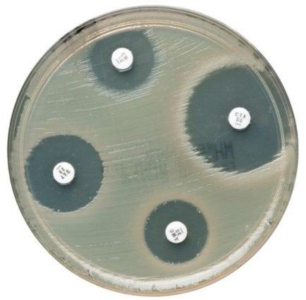 Vibles Antimicrobial Susceptibility Rings