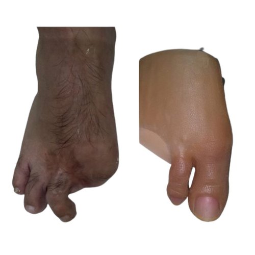 Silicone Artificial Foot Finger, Color : Skin Color