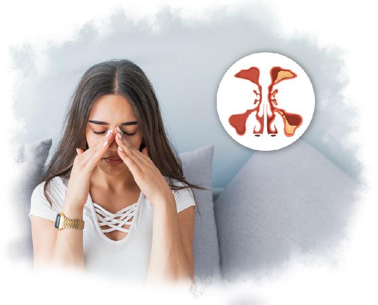 Ayurvedic Treatment for sinusitis at Rs 250 / Appointment in Ludhiana