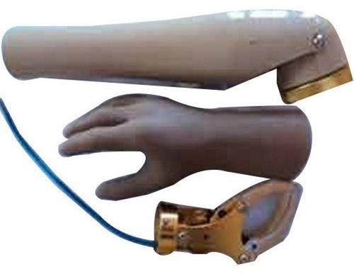 Above Elbow Prosthesis