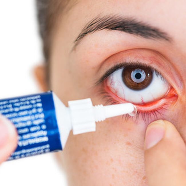 Pharmaceutical Eye Ointments, for Clinical, Form : Gel
