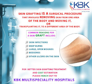 Skin Grafting Wounds Treatment