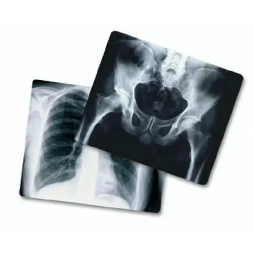X Ray Films at best price INR 500 / Pack from ExpertLabo ID6509101