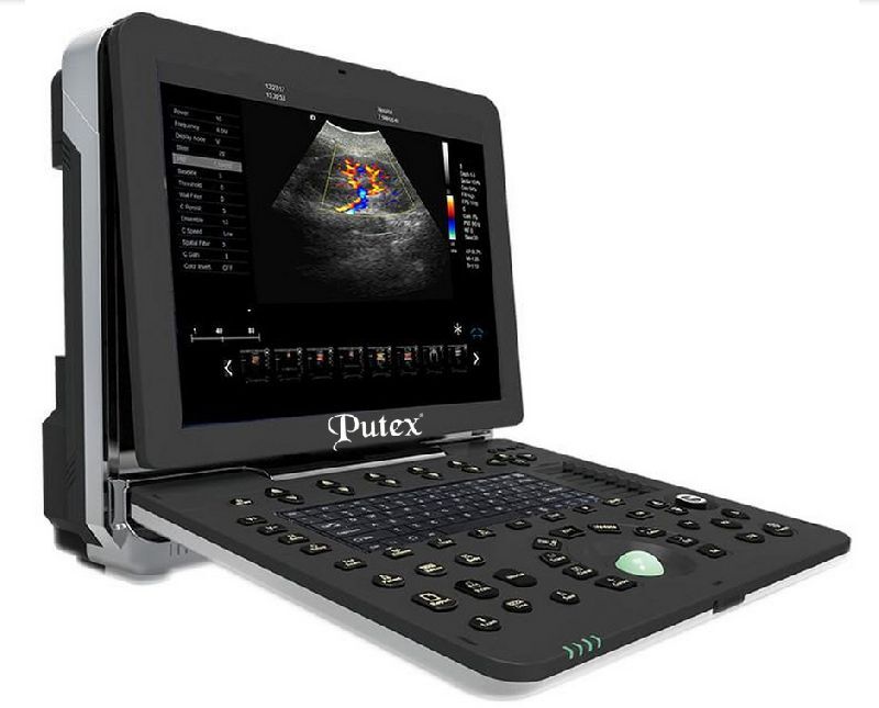 ULTRASOUND SCANNER, Screen Size : 15 inch LED screen