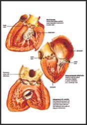 HUMAN DISEASES 3D CHARTS