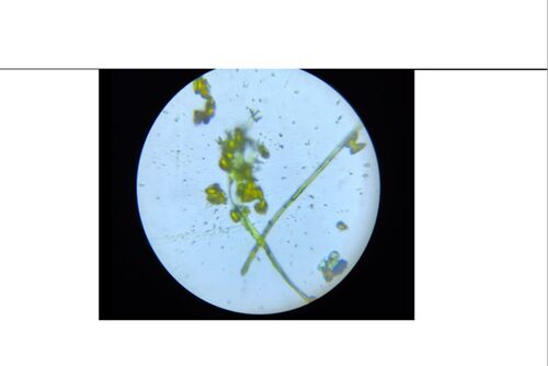 Soil Microbes