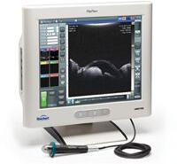 Reflex ultrasound biomicroscopy