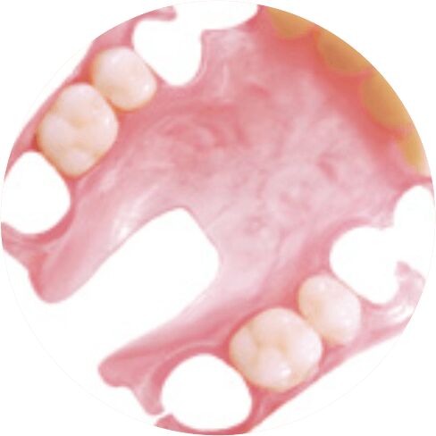 Flexible Dentures Treatment Services