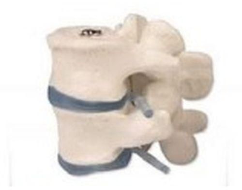 2 Lumbar Vertebrae 3D Anatomical Model