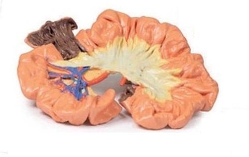 Bowel Portion Lleum 3D Anatomical Model