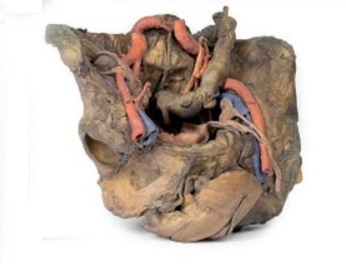 Female Pelvis Deep Dissection 3D Anatomical Model