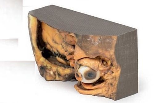 Lateral Orbit 3D Anatomical Model