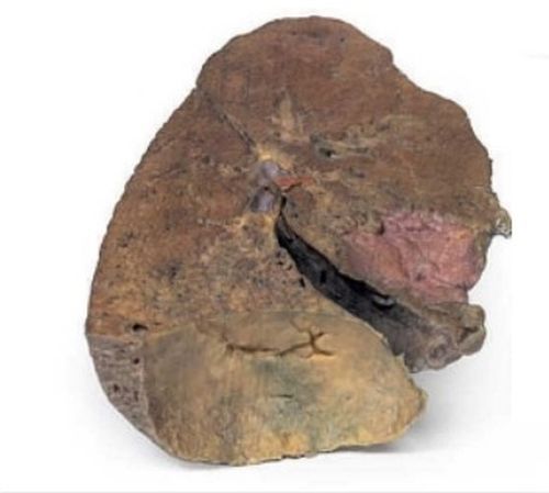 Lung Slab Hilum 3D Anatomical Model