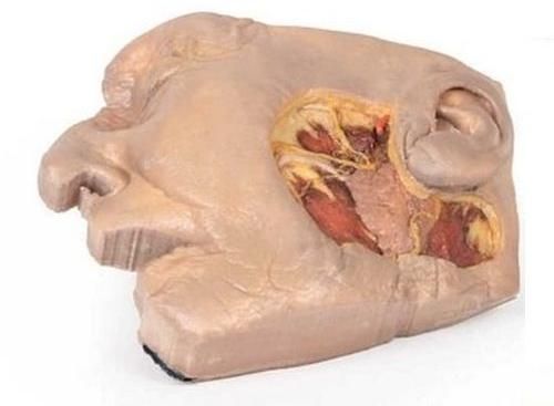 Parotid Gland and Facial Nerve Dissection 3D Anatomical Model