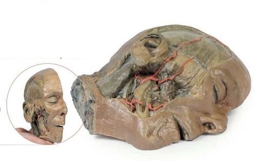 Sagittal Section Head With Infratemporal Fossa Dissection 3D Anatomical Model