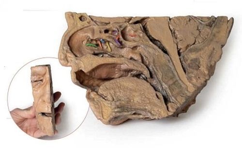 Sinus Pathways 3D Anatomical Model