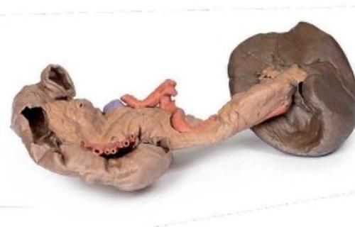 Spleen and Pancreas 3D Anatomical Model