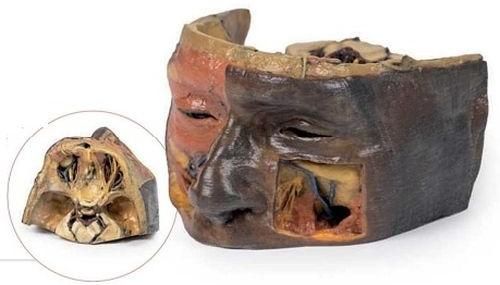 Superior Orbit 3D Anatomical Model