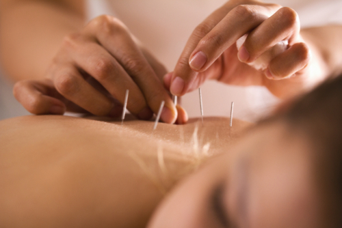 Acupuncture Treatment Services