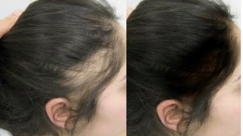 Swazallik Hair Growth Serum