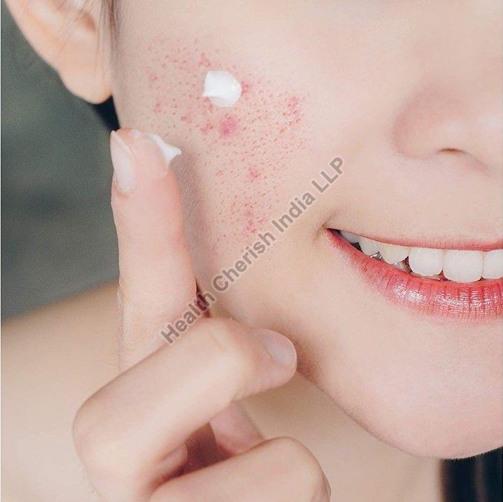 Dr. Mantra Acne Treatment Cream