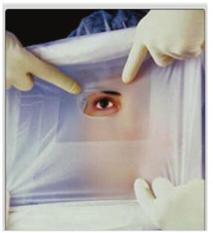 Surgical Eye Drape, for Clinic, Hospital, Pattern : Plain