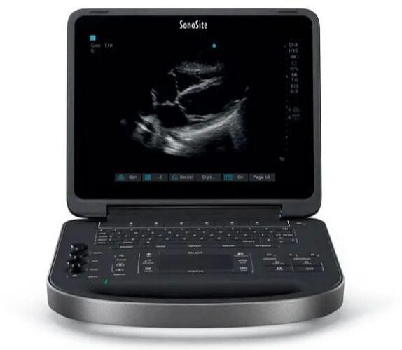 Point Of Care Ultrasound Machine, Model Number : Edge II