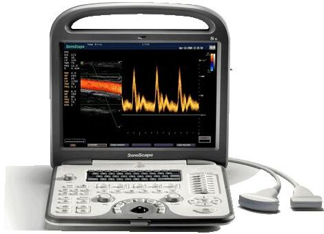 Sonoscape S6 Colour Doppler Ultrasound