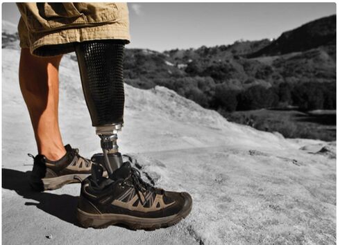 Carbon Fiber Prosthetics Foot