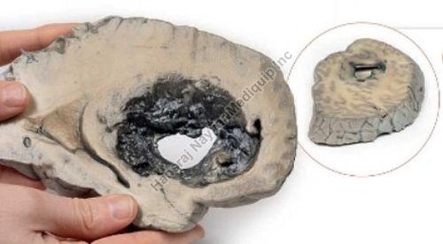Cerebral Haemorrhage 3D Anatomical Model, for School, Science Laboratory, Feature : Accurate Design