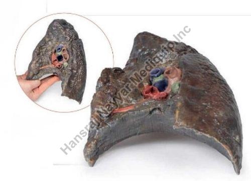 Right Lung Hilum 3D Anatomical Model, for School, Science Laboratory, Feature : Accurate Design, Crack Proof