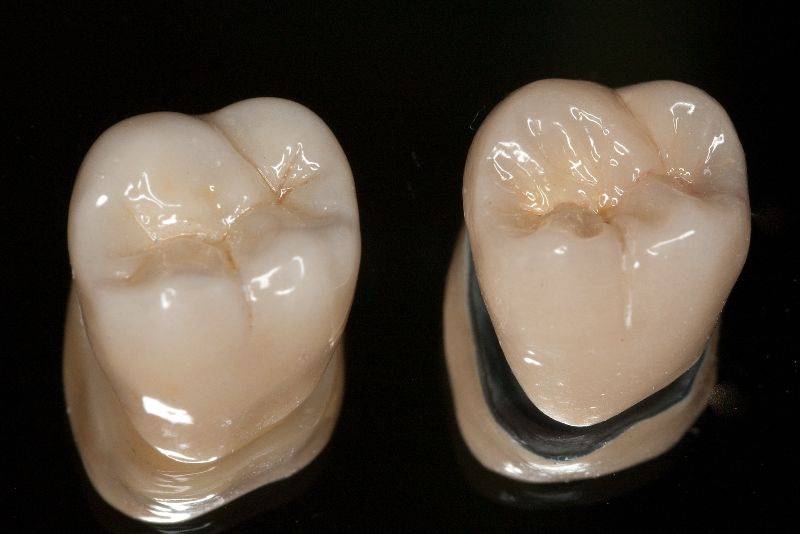 Zirconia crowns, for Dental Clinic