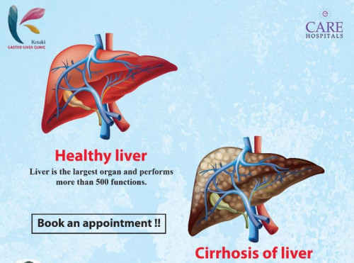 Liver Fibroscan Service