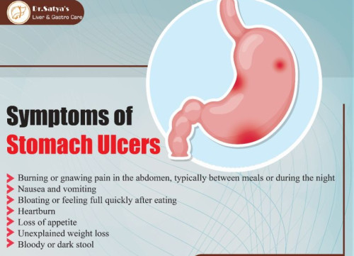 stomach ulcers gastroenterologist service