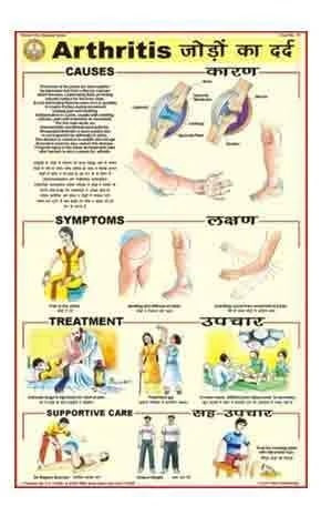 Paper Arthritis Chart for Biological Labs, Hospital, School