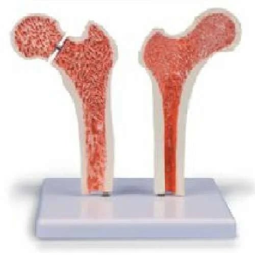 PVC Femur Bone Joint Model for Medical College
