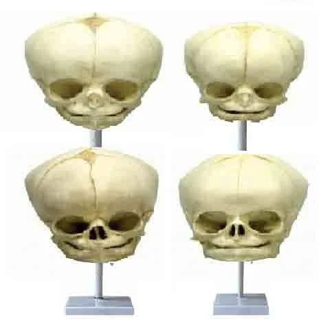 Polished Fetal Child Skull Model for Medical College