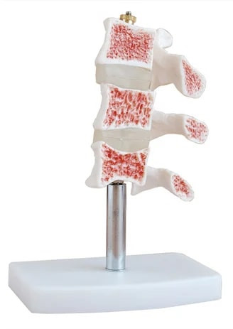 PVC Osteoporosis Bone Joint Model for Medical Institute, Nursing Institute