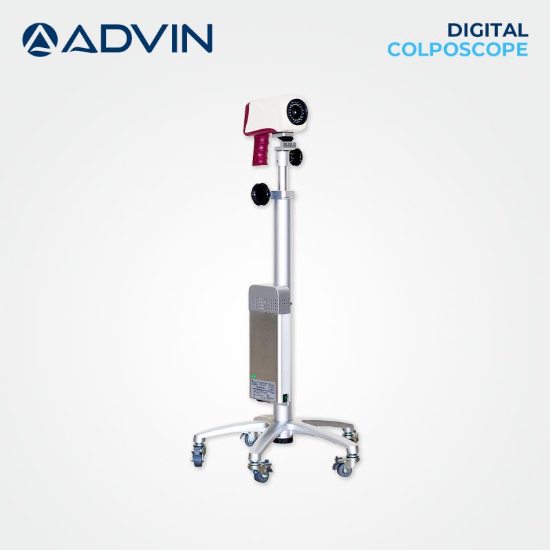 Digital Video Colposcope